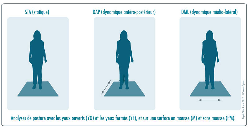 Figure 1 : Illustration du protocole. Analyses de posture avec les yeux ouverts et les yeux fermés, et sur une surface en mousse et sans mousse, en statique, en position instable sur le plan médio-latéral et en position instable sur le plan antéro-postérieur.