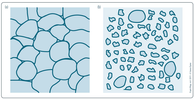 Figure 3 : Coupes transversales permettant de comparer d'un côté des fuseaux musculaires sains, aux cellules de taille homogène et de contours lisses et réguliers, proches les unes des autres, avec de l'autre côté des fibres musculaires atrophiées, aux cellules plus petites, anguleuses, de