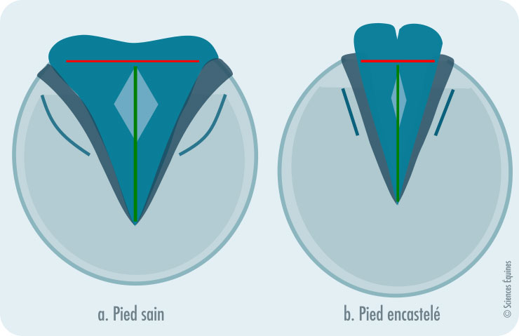 La figure montre le dessous de deux pieds. À gauche, un pied sain (fourchette presque aussi large que longue) et à droite, un pied encastelé (fourchette longue et étroite).